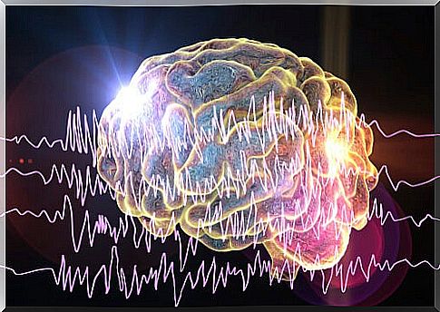 Brain with seizures