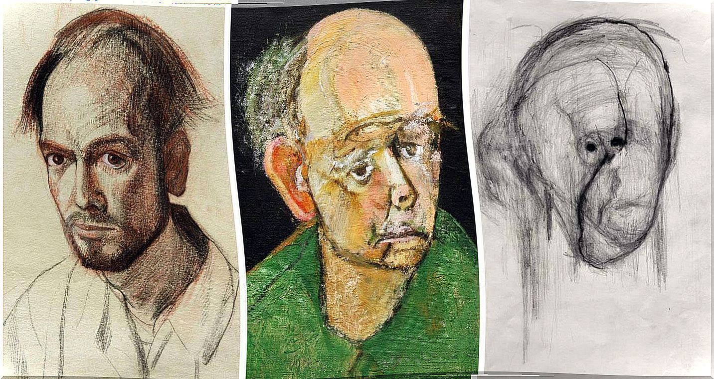 The evolution of Alzheimer's disease through art